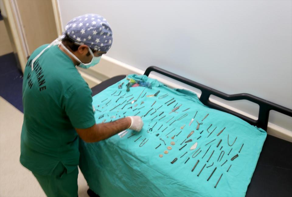 <p> Endoskopiyle çıkarmayı düşündük fakat iğne büyük olduğu için ameliyata aldık. Ameliyatta bizi şok eden manzarayla karşılaştık. </p>