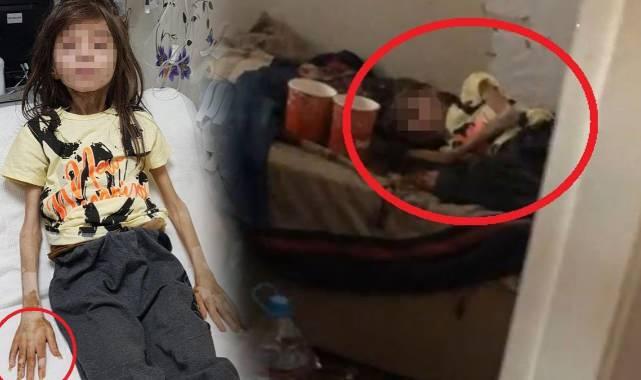 <p>Özkan, "Kalp hızında sıkıntıları var. Onu takip ediyoruz. Sürekli hemşire ve doktorlarıyla konuşması, iletişim kurması çok güzel. Tedavisi birkaç hafta daha sürdükten sonra taburcu edeceğiz. Medikal olarak toparlayacak ama kalbindeki yaraları sarmak çok da kolay olmayacak. O anlamda destek olmak çok önemli. Sosyal hizmetlerin çok titiz bir şekilde takip edeceğine ve çocuğumuza güzel bakacağına eminim. Bütün toplumun sevgi vermesi gerekiyor. Sevgi onu düzeltecek" diye konuştu.</p>
