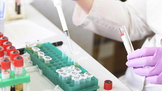 <p>Evdeki izolasyonlarında hane halkı ile aynı ortamda bulunmadan kendilerini mümkünse ayrı bir odada izole ederler. Hane halkı ile aynı ortamda bulunulduğunda maske takılır." denildi.</p>