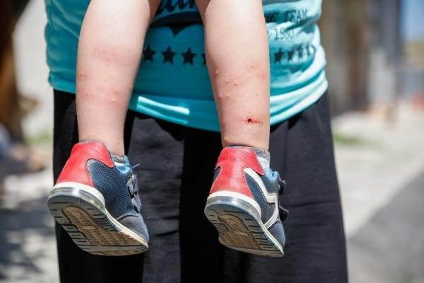 <p>İstanbul'da 'Aedes' türü sivrisineklerde artış yaşanıyor. Özellikle zika virüsü bulaştıran 'Aedes' türü sivrisineklerle mücadelede ilaçlamanın yeterli olmadığı belirtiliyor. </p>
