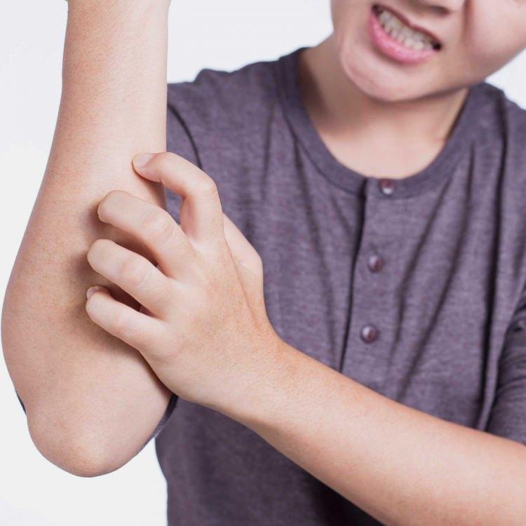 <p><strong>Acilleri dolduran bu vakalar konusunda uzmanlar kişilerin evlerini sürekli havalandırarak ilaçlanması gerektiğini ve C vitamini ağırlıklı beslenmenin öneminin altını çizdi. </strong></p>