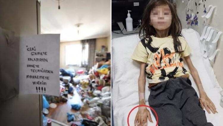 <p>"Bu çocuk muhtemelen ilk etapta devlet denetimine geçeceği için, orada uygun bir ortam hazırlanıyor. O ortam için haber bekliyoruz. İlk geldiğinde 17 kiloydu, şu anda 20'ye yaklaştı. Taburcu olduktan sonra da elbette çok sık göreceğiz"</p>
