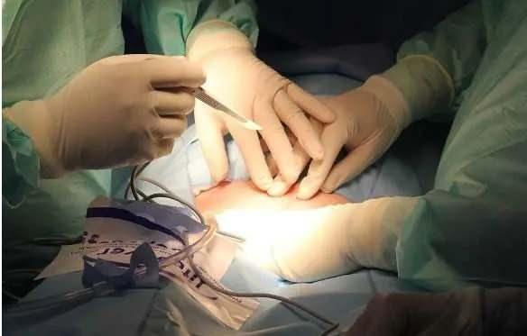 <p>Gelişen yeni implant teknolojiyle burun örneği hastanın kolunda deri altına nakledildi. İki ay içinde kolunun alt bölgesindeki doku, hücre ve kan damarlarının gelişmesiyle Carine'nin burnu kolunda yeniden doğdu.</p>