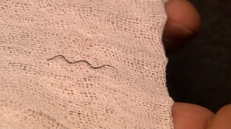 <p>BOĞAZINDA 2 BU&Ccedil;UK SANTİMETRE TEL OLDUĞU TESPİT EDİLDİ</p>

<p>&nbsp;</p>

<p>Gitmiş olduğu hastanede &ccedil;ekilen tomografi sonucuyla b&uuml;y&uuml;k şok yaşadı. Faruk Karayel&rsquo;in boğazına yapışmış 2 bu&ccedil;uk santim b&uuml;y&uuml;kl&uuml;ğ&uuml;nde tel olduğu tespit edildi. Karayel&rsquo;in boğazına 5 saat boyunca yapışık şekilde kalan tel hastanede&nbsp; operasyonla &ccedil;ıkartıldı. Yaşadıklarını anlatan Faruk Karayel, <em><strong>&ldquo;Denetimler sıklaştırılmalı, &ccedil;ocuklarım yemiş olsaydı daha k&ouml;t&uuml; şeyler olabilirdi&rdquo;</strong></em> dedi.</p>
