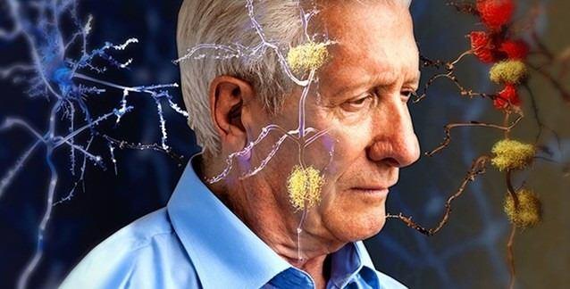 <p>Özetle yapmaya çalıştığımız bu düzenekle Türk toplumunu taramaya ve tanımlamaya çalışmak. Taradıktan sonra erken yaşlanmaya, ya da yaşlılığa bağlı hastalıklara yatkınlığı olan bireyleri önceden belirleyebilmek için biyobelirteç/biyoajan bulmak ve sonrasında erken yaşlılığa veya yaşlılığa bağlı hastalıklar (Alzheimer, Parkinson, Kanser gibi) için çevresel faktörlere bağlı olarak hastalıkların ortaya çıkışını geciktirmek için yöntemler oluşturmak ve oluşturduğumuz hücre hattı modellemesi ile tedaviyi nasıl yapabiliriz sorusunun yanıtını bulmak istiyoruz.</p>