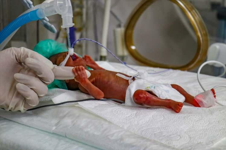 <p>Van Yüzüncü Yıl Üniversitesi (Van YYÜ) Dursun Odabaş Tıp Merkezi Yenidoğan Yoğun Bakım Ünitesi'nde görevli sağlık çalışanları, 400 gram olarak dünyaya gelen bebeğe hayata tutunması için özenle bakıyor. </p>
