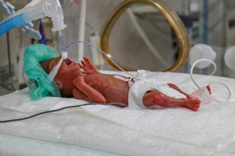 <p>Organları gelişmeyen ve solunum yetmezliği yaşayan "parmak bebek"i kuvöze alan sağlık çalışanları, beslenmesinden bakımına tüm ihtiyaçlarıyla yakından ilgileniyor.</p>