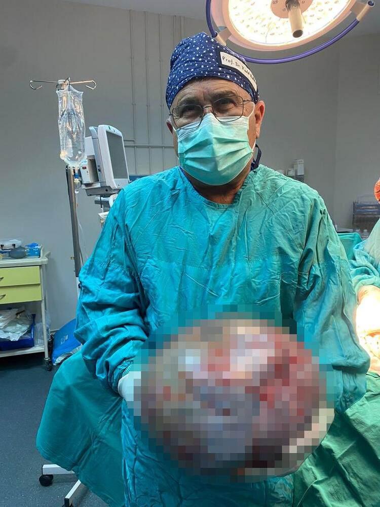 <p>Başarılı geçen operasyon sonrası Münevver Hilal Yiğit, "İkiz bebek kadar büyüklükte bir karnım oldu. Beni bunaltmaya başladığında da profesör Osman Fadıl Kara hocama başvurdum. Hocam da burada ameliyatımı yaptı.</p>
