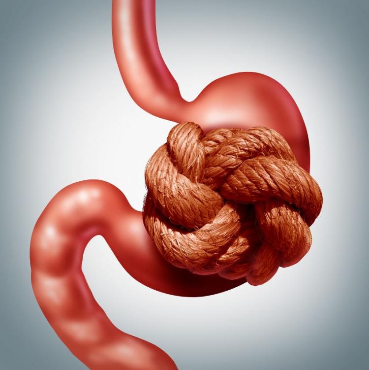 <p><strong>Kabızlığın tedavisi hakkında bilgilerini aktaran Karatay, kabızlık sorunu için bazı gıdaları evlerimizden eksik etmemiz gerektiğini söyledi.</strong></p>
