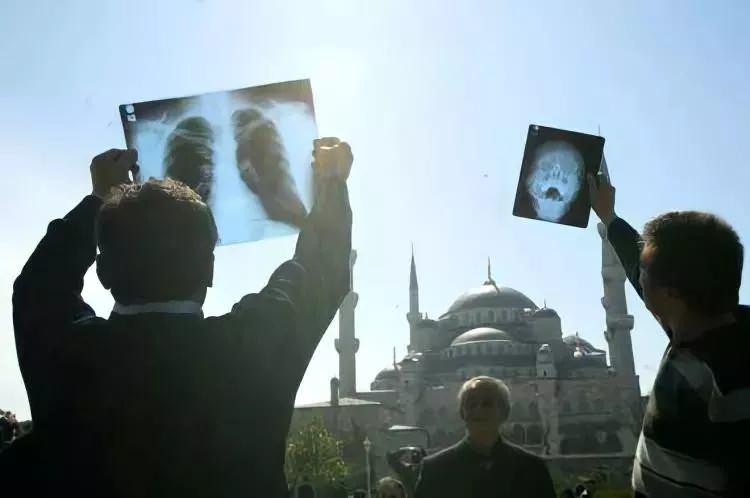 <p>Akciğer film röntgeninden güneş tutulmasını izleyen vatandaşlar. İstanbul 1999</p>