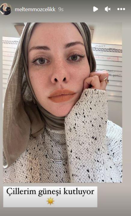<p><strong>Meltem Özçelik daha önce sosyal medyadan yayınladığı karesine <span style="color:#B22222">"Çillerim güneşi kutluyor"</span> notunu düşmüştü. </strong></p>
