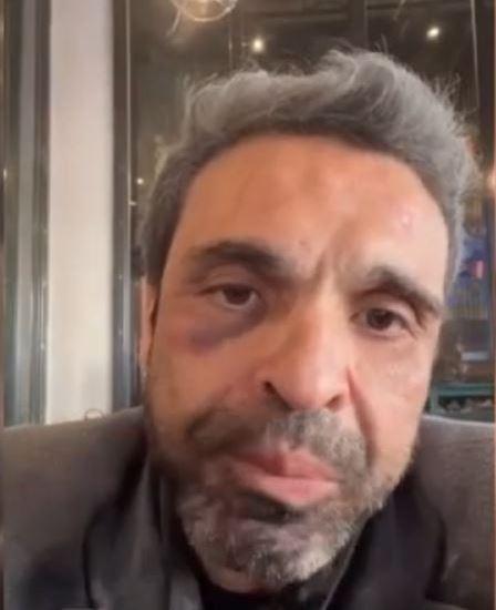 <p><strong>Alacaklarımı vereceksin. Bugün sinemaya 1 milyon kişi gelse 36 milyon para yapar. O parayı sana bırakmayacağım. Babanı mezardan kaldıracağım. O kızlar sana emanetmiş Allah belanızı versin"</strong> cümlelerini kurduğu videoyu sosyal medya hesabından yayınladı.</p>
