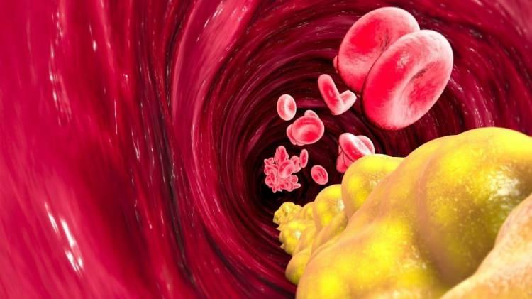 <p><span style="color:#800000"><strong>Kolesterol insanların kanında bulunan ve başta karaciğerde olmak üzere bütün hücreler tarafından doğal olarak üretilen, mumsu yapıya sahip bir lipid yani yağ türüdür. </strong></span></p>
