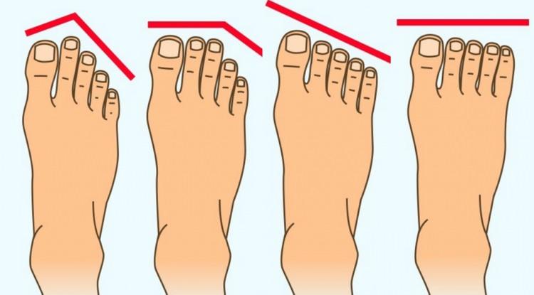 <p><span style="color:#B22222"><em><strong>Bilim insanlarının yaptıkları araştırmalara göre ayak parmak şekilleri kişinin genetik kodlarına dair merak edilen bilgileri basit bir şekilde öğrenme imkanı tanıyor. Buna göre genetik olarak ayak parmaklarının uzunluk ve kısalıklarına hatta dizilişlerine göre köklerinizi ve atalarınızın kim olduğunu öğrenebilirsiniz. İşte, ayak şekline göre ırk tespiti yapmanın tek formülü...</strong></em></span></p>
