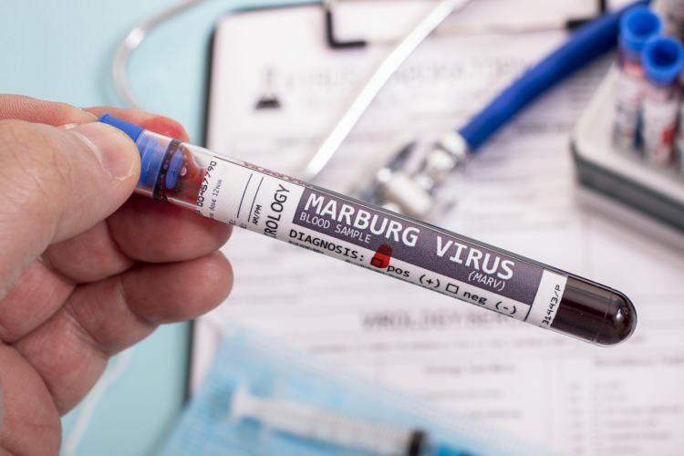 <p><strong>“Hasta bir kişide bulgular ortaya çıkana kadar hastalık bulaşıcı değildir. 5-10 günlük kuluçka süresinden sonra başlangıç semptomları aniden başlar ve ateş, titreme, baş ağrısı, kas ağrısı şeklindedir. Bulguların başlamasından sonra 5’inci gün civarında gövdede döküntüler ortaya çıkabilir. Mide bulantısı, kusma, göğüs ağrısı, boğaz ağrısı ve ishal görülebilir. Bulgular gittikçe şiddetlenerek sarılık, pankreas iltihabı, ciddi kilo kaybı, hezeyanlar, karaciğer yetmezliği, yaygın kanamalar görülmeye başlanır. Ölüm oranları geçmiş salgınlarda yüzde 24 ile yüzde 88 arasında değişmiştir. Hastalığın seyri esnasında ve iyileştikten sonra yapılan kan testleriyle tanı konur. Ölen hastalarda kan ve doku örneklerinde geriye dönük olarak Marburg Kanamalı Ateşi teşhisi konulabilir.</strong></p>
<p> </p>