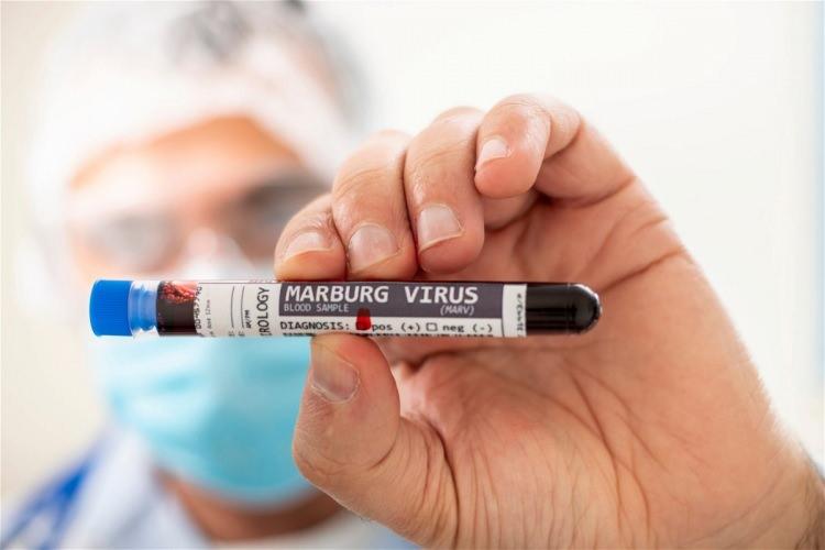 <p><strong>“Marburg virüsünün şu anda onaylı bir aşısı veya özel tedavisi yoktur. Hastanede destek tedavisi uygulanmalıdır. </strong></p>