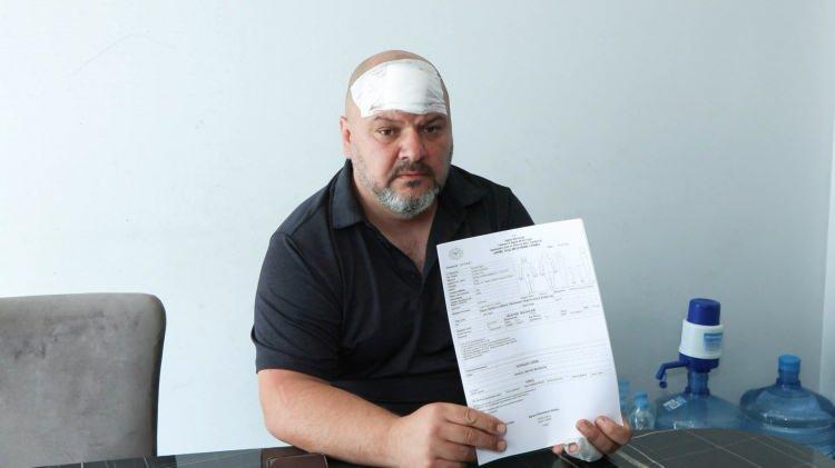 <p>Başakşehir'de iddiaya göre sitede oturan Hasan Eğilmez'in (46) ev sahibi 30 bin lira olan kirasını 100 bin lira yapmak istedi. Bu teklifi kabul etmeyen Eğilmez, iddiaya göre, ev sahibinin de aralarında bulunduğu bir grup tarafından beyzbol sopasıyla darp edildi. Ev sahibi tarafından 1 yıldır sözlü taciz ve tehdit edildiğini söyleyen Hasan Eğilmez, "Beyzbol sopasıyla 4-5 darbe vurdular arkamdan. Tabii ki darbelerin etkisiyle yere düştüm. Ben kanlar içinde yerde yatarken beyzbol sopasıyla tekrar başıma vurdular. Güvenlikler müdahale etmeye çalıştı. Onlara da saldırdılar. Sonrasında zaten bir arkadaşım beni aldı siteden çıktık. Direkt hastaneye gittik. Çünkü aşırı kan kaybı vardı. Ben bu kişilerden zaten şikayetçi olacağım." dedi.</p>