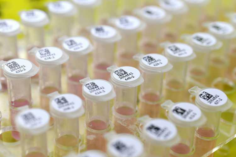 <p>LEJYONER HASTALIĞI NEDİR?</p>

<p> Lejyoner hastalığı legionella pneumophila bakterisinin neden olduğu ciddi bir akciğer hastalığı olarak biliniyor. Söz konusu bakteriye maruz kalan çoğu kişi hastalığa yakalanmazken, 50 yaş üstü kişiler, kronik akciğer rahatsızlığı, böbrek ya da karaciğer yetmezliği olanlar, kanser hastaları, bağışıklık sistemi zayıf kişiler, diyabet hastaları ve sigara içenlerin hastalığa yakalanma oranı daha yüksek. </p>
