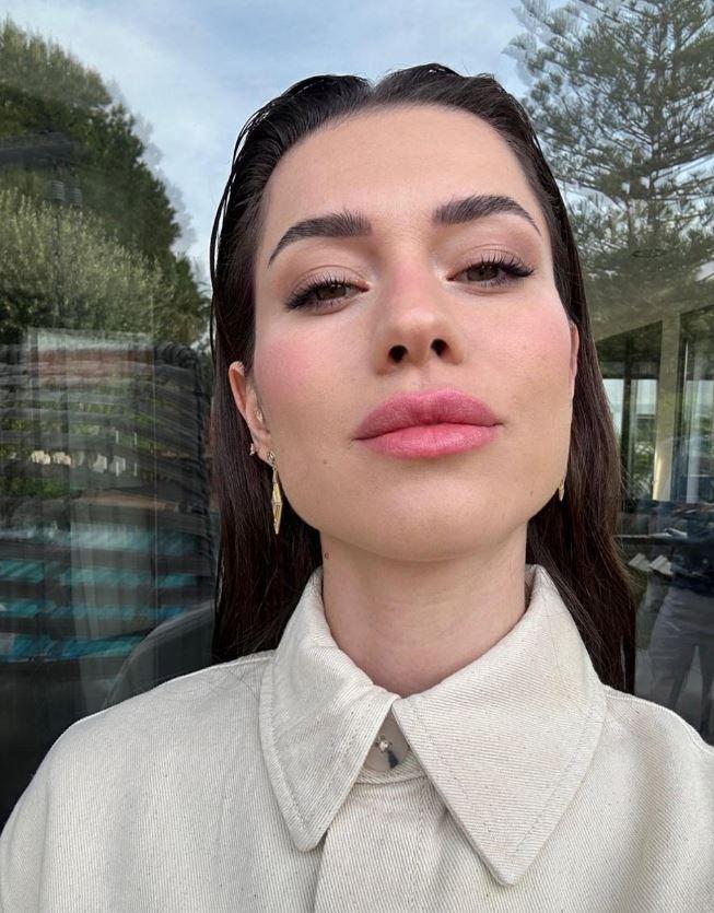 <p><span style="color:#FF0000"><strong>"KARŞI TARAFI DA SUÇLAMIYORUM"</strong></span></p>

<p><span style="color:#000000"><strong>Daha önce hiç böyle bir durumla karşı karşıya kalmadığını dile getiren güzel oyuncu, sözlerini şöyle sürdürdü:</strong></span></p>

<p><span style="color:#000000"><strong>"Cildim akneye meyilli ve çok hassastır. Ancak ben ömrümde böyle bir olay yaşamadım. Başkasının yaşadığını da duymadım. Basit bir şey gibi görülebilir bu kullanılan kremler, yağlar ancak sonucunda beni çok etkiledi. Karşı tarafı da suçlayamıyorum.</strong></span></p>

