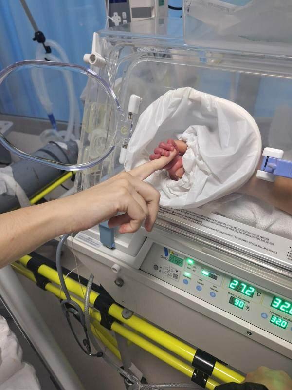 <p><strong>“İlk önce bebeği, birinci canı kurtarmayı planladık”</strong></p>
<p>Hastanemizde sağlıklı bir şekilde doğumu gerçekleştirdiklerini belirten Op. Dr. Keskiner, “Biz öncelikle bebeği, birinci canı kurtarmayı planladık. Sağlıklı bir şekilde doğumu gerçekleştirdik. Biraz erken doğum olması nedeniyle yeni doğan yoğun bakımda klinik takibini yaptık. Sonra da annenin bekleyecek zamanı olmadığı için beyin tümörüne yönelik cerrahi müdahale planladık ve çok başarılı bir operasyon gerçekleştirdik; fakat beynin inanılmaz plastik bir özelliği vardır. Tıpkı hamur kıvamındadır. Uzun süre baskıda kalan beyin dokusu üzerindeki baskıyı ortadan kaldırsanız dahi; yani tümöral kitleyi çıkarsanız bile beyin fonksiyonları geri dönmeyebilir. Bütün çabalarımıza rağmen, annenin beynindeki baskı ve ona bağlı dolaşım bozuklukları normale dönmedi ve beyin ölümünden hastamızı maalesef kaybettik. Bütün bu süreç 18 Eylül'de başlayıp 25 Eylül'de yani bir hafta içerisinde yaşandı” şeklinde konuştu.</p>