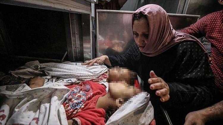 <p>Büyük çoğunluğunu çocukların oluşturduğu sivil kayıplar gözünü kan bürüyen İsrail'in saldırıları sonucu gün geçtikçe artarak devam ediyor.</p>
