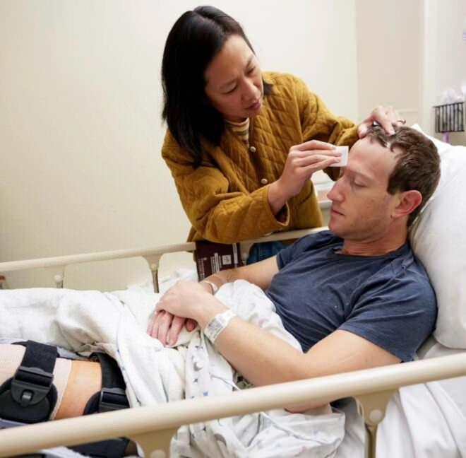 <p>Stanford Medicine'a göre, ACL ameliyatı için rehabilitasyon birkaç ay sürebilir ve çoğu sporcu işlemden dokuz ila 12 ay sonra tam aktiviteye dönebilir.</p>
