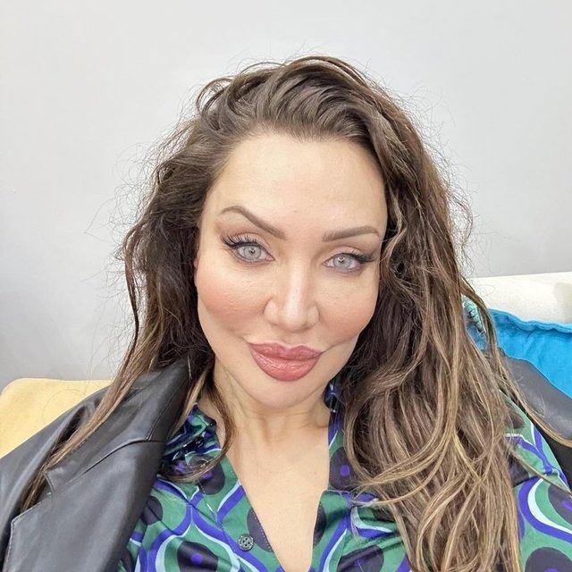 <p>İşleminin başarılı ge&ccedil;tiğini s&ouml;yleyen Aky&uuml;rek<strong>, "Ameliyatım başarılı ge&ccedil;ti, geceyi hastanede ge&ccedil;irdim. her şey yolunda. T&uuml;rkiye'de sadece benim hocam yapıyor bu ameliyatı. &Uuml;lkemizde de yeni yeni duyulmaya başlandı. &Ccedil;ok basit bir operasyon, 1 saat s&uuml;rd&uuml;. Şişlik, &ouml;dem ve morarma yok." </strong>dedi.</p>

<p>&nbsp;</p>
