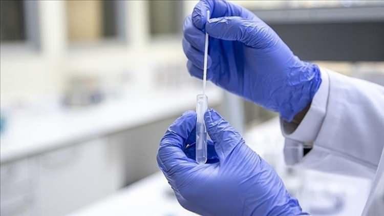 <p>WHO'nun risk değerlendirmesinde, "<strong>Bu varyantın, özellikle kış mevsimine giren ülkelerde diğer viral ve bakteriyel enfeksiyonlardaki artışın yanı sıra koronavirüs vakalarında artışa neden olabileceği öngörülüyor" deniliyor.</strong></p>

<p>WHO'ya göre, JN.1'in aşıların sunduğu bağışıklığı ne kadar aşabildiği konusunda hâlâ sınırlı kanıt bulunuyor.</p>

<p>Bu varyantın insanları öncekilere göre daha fazla hasta ettiğine dair bir kanıt yok.</p>
