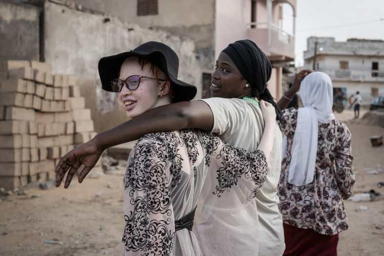 <p>Albino bireyler, dünyanın dört bir yanında olduğu gibi Senegal'de de farklı görünüşlerinden dolayı ayrımcılığa maruz kalıyor. Senegal'in başkenti Dakar'da yaşayan Penda Fall, bir gün pediatri uzmanı olmak, böylece albinizm ve diğer hastalıklardan muzdarip çocuklara yardım etmek istediğini söyledi.</p>
