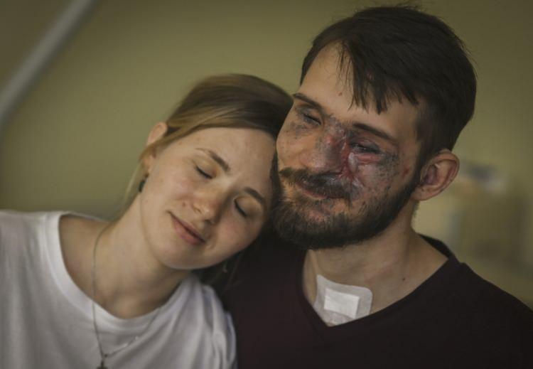 <p>Rusya'nın Ukrayna'ya yönelik başlattığı savaşta kolları ile gözlerini kaybederek ağır yaralanan Ukraynalı asker Andrey Smolenskiy, ülkesinde özgürce yaşamak istiyor. İşitme sorunu da bulunan, birçok kez ameliyat geçiren Smolenskiy, psikolojik ve fizik tedavi görürken, eşi Alina Smolenskaya da hep yanında destek veriyor.</p>