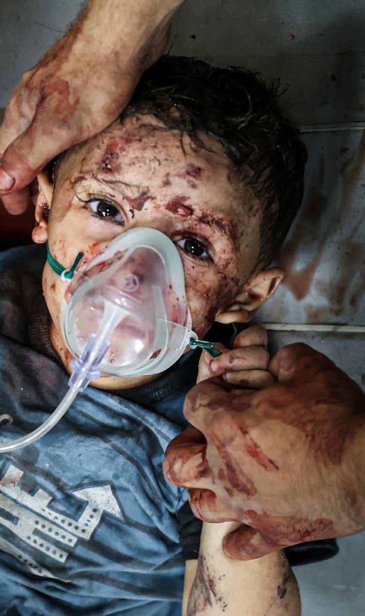 <p>&nbsp;İsrail ordusunun Gazze&rsquo;deki Deir Al Balah kentine d&uuml;zenlediği saldırı sonucu aralarında &ccedil;ocukların da bulunduğu yaralılar, tedavi i&ccedil;in Aksa Şehitleri Hastanesi'ne getirildi.</p>
