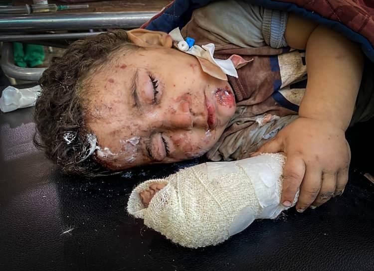 <p>Gazze'deki El-Ehli Baptist Hastanesi'nde g&ouml;revli sağlık &ccedil;alışanları, saldırılar nedeniyle bazı b&ouml;l&uuml;mlerin hasar g&ouml;rmesi &uuml;zerine yaralıları bah&ccedil;ede tedavi etti.</p>
