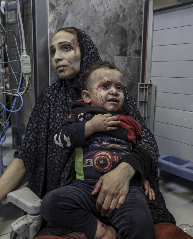 <p>Gazze'deki Sağlık Bakanlığı S&ouml;zc&uuml;l&uuml;ğ&uuml;, İsrail&rsquo;in Gazze'deki El-Ehli Baptist Hastanesi'ni bombalaması sonucu &ccedil;ok sayıda kişinin &ouml;ld&uuml;ğ&uuml;n&uuml; bildirdi. &Ccedil;ok sayıdaki yaralı ise Gazze kentindeki Şifa Hastanesi&rsquo;ne kaldırıldı.</p>
