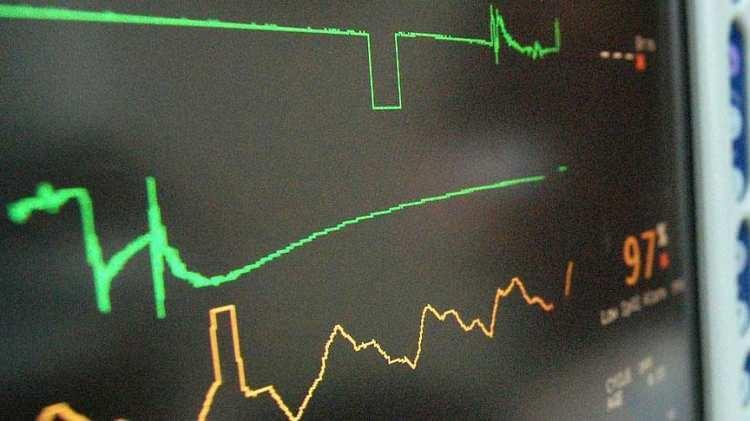 <p><strong>DOLAŞIM SİSTEMİ HASTALIKLARI KAYNAKLI ÖLÜMLERİN EN AZ GÖRÜLDÜĞÜ İLLER</strong></p>