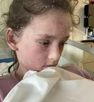 <p>Avusturalya'da bir kız "kendine karşı alerji" hastalığına yakalandı.  Summah Williams isimli 11 yaşındaki kız çocuğu, gözyaşları ve terinin acı vermeye başlaması üzerine doktora gitti. </p>
