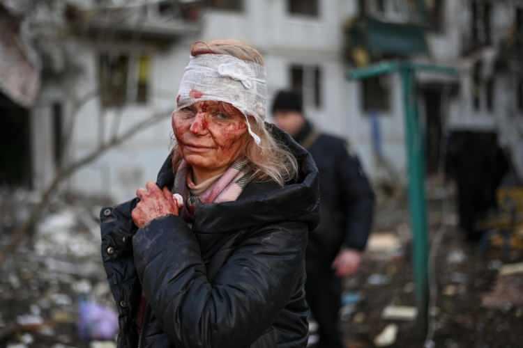 <p><span style="color:#FF0000"><strong>AA'nın fotoğrafı Rusya-Ukrayna Savaşı'nın unutulmaz karesi oldu</strong></span></p>

<p> </p>
