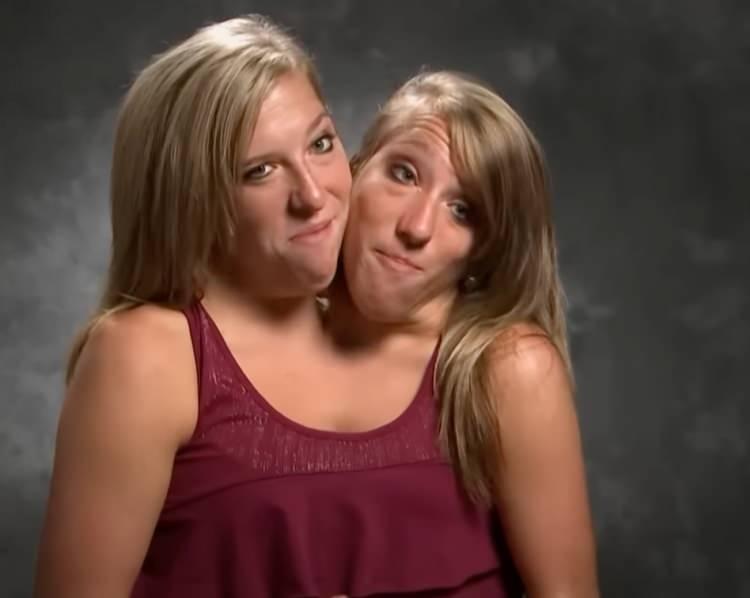 <p><strong>TLC programı ile ünlenen ve son derece nadir bir formu olan "disefalik parapagus" ikizleri olarak kabul edilen 'Abby ve Brittany' kardeşler, birkaç popüler programlarda kendini gösterdi.</strong></p>

<p> </p>

