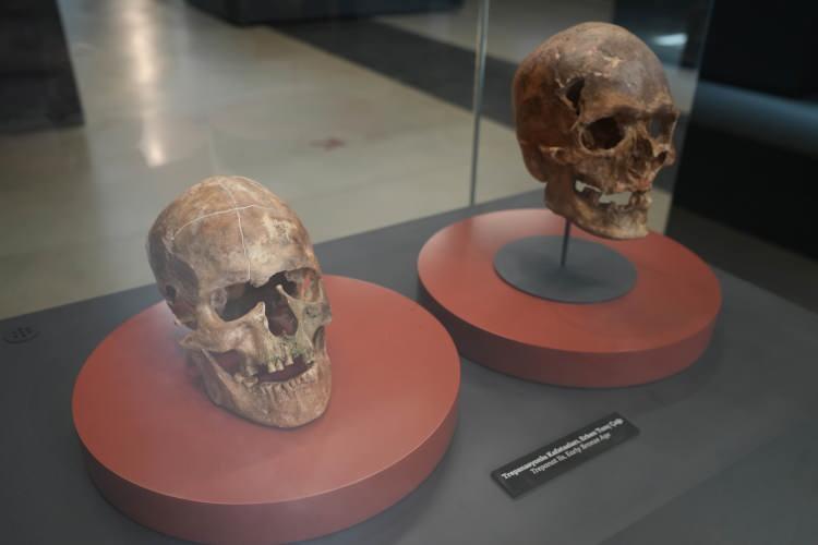 <p>Samsun Müzesi’nde sergilenen kafatası, vatandaşlar tarafından da ilgiyle incelenirken, aynı bölümde trepanasyon (Baş delgi) tekniğiyle kafatası ameliyatı yapılmış 1900 yıllık kafatası da sergileniyor. Ameliyat edilen kafataslarından 5 bin yıllık olanı ilk Tunç Çağı'na, 1900 yıllık olanının ise antik Amisos Kenti Geç Hellenistik ve Erken Roma İmparatorluk dönemine ait olduğu tespit edildi.</p>

