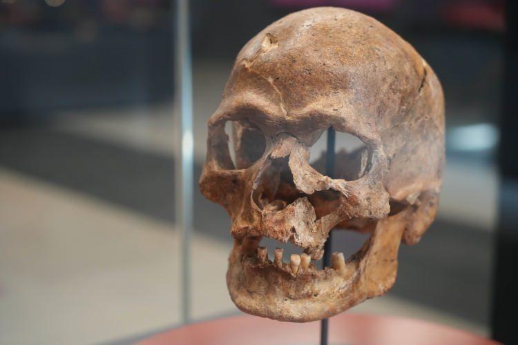 <p>1981 yılında Samsun’un Bafra ilçesi İkiztepe Höyüğü arkeolojik kazılarında bulunan 5 bin yıllık kafatası, baş delgisi tekniğinin ilk Tunç Çağı’nda kullanıldığını belgelemişti. </p>

