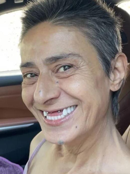<p>Yıldız Tilbe, dişlerinin yeni halinin görüntüsünü de Instagram hesabından art arda karelerle paylaşmayı ihmal etmedi.</p>

<p> </p>
