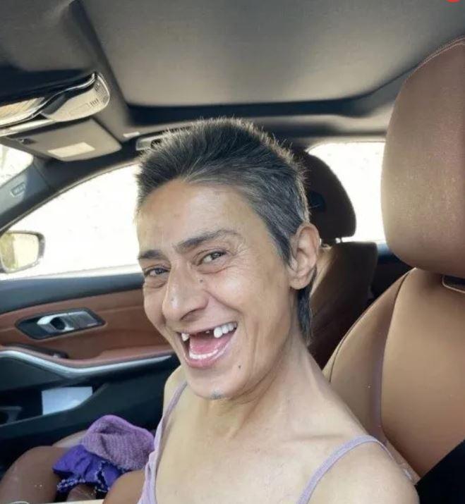 <p>Fotoğrafları çok konuşulan Yıldız Tilbe'nin implant tedavisi tamamlandı. </p>

<p> </p>
