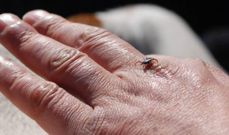 <p>KKKA hastalığı şüphesiyle anestezi yoğun bakım servisinde tedavi altına alınan Ş.T, müdahaleye rağmen kurtarılamadı.</p>
