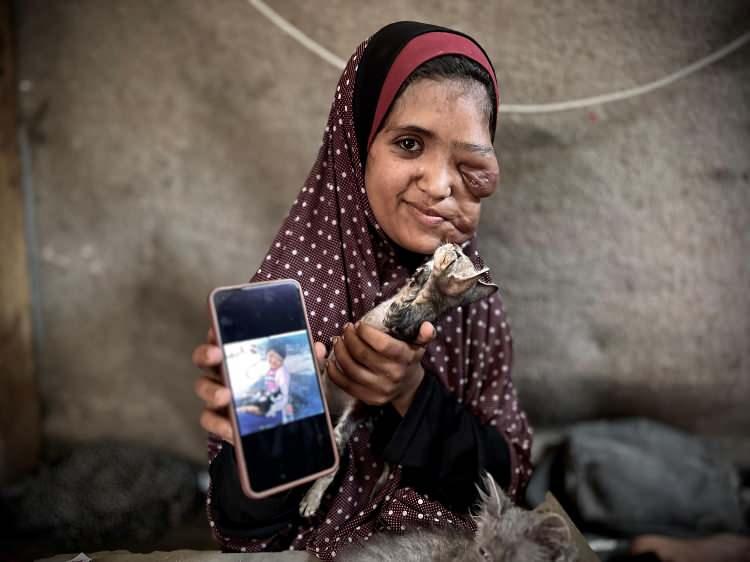<p>İsrail'in 7 Ekim'den bu yana Gazze Şeridi'ne düzenlediği saldırılarda en az 15 bin 694’ü çocuk, 10 bin 279'u kadın olmak üzere 37 bin 372 Filistinli öldürüldü, 85 bin 452 kişi yaralandı.</p>
