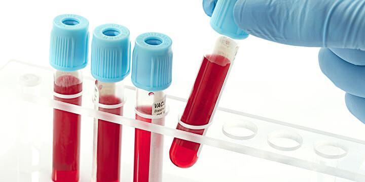 <p>Kan grupları, kan transfüzyonları, organ nakilleri ve bazı genetik hastalıkların tedavisinde önemli bir rol oynar. Ayrıca, bir kişinin kan grubu belirliyor ve bu nedenle acil bir transfüzyon gerektiğinde hızlı bir şekilde uygun kanı bulmaya yardımcı oluyor.</p>