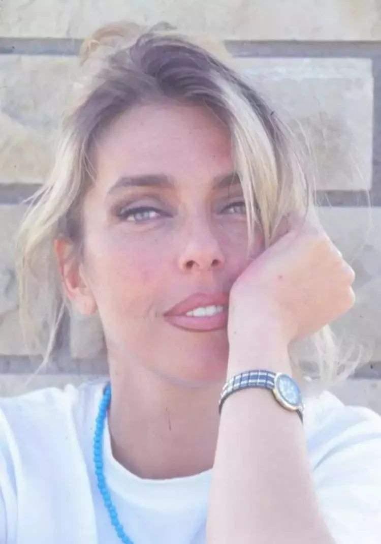 <p> Annesinin KOAH hastası olduğunu söyleyen Anjelik Calvin; "Vücudundaki oksijen seviyesi düşmüştü. Ambulans yetişmeseydi her şey daha da kötü olabilirdi. Kalp damarları açıldı. Annem, burnundan rahat nefes alamıyor, burnunda kemik ve nodüller var" dedi.</p>