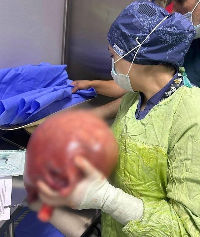 <p>"Bu durum bütün kadınlarda vardır, yaygındır. Kiminde çok küçüktür, çok küçük olanlar semptom vermediği için çok fazla bilinmezler açıkçası."</p>
<p> </p>