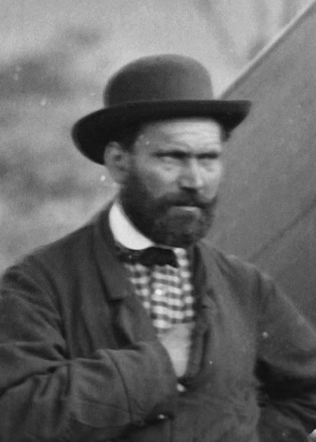 <p>Allan Pinkerton, 1884 yılında bir kaldırımda yürürken kayarak dilini ısırmıştı. Bu talihsiz ısırık daha sonra enfeksiyona dönüştü ve Pinkerton`ın hayatına maloldu.</p>
