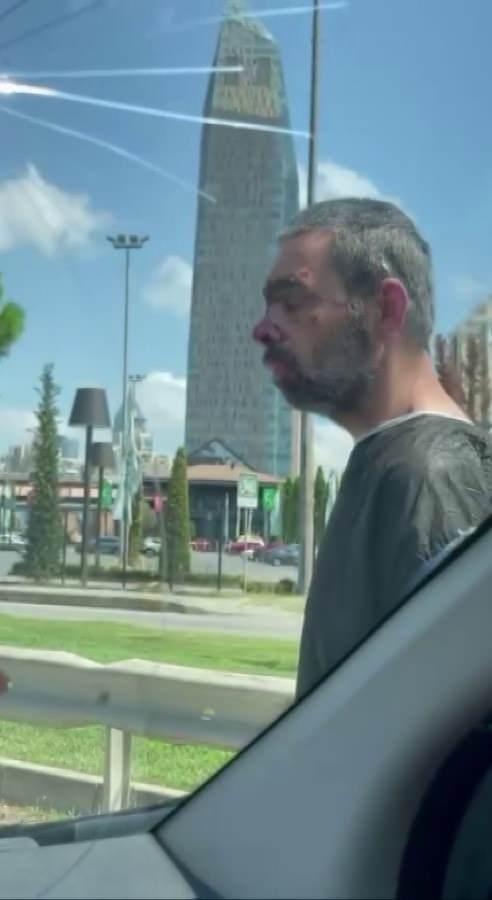 <p>O sırada yanından geçen araçtan şahsı görüntüleyenler, adamın yüzünün yaralar içinde olduğunu kaydetti.</p>