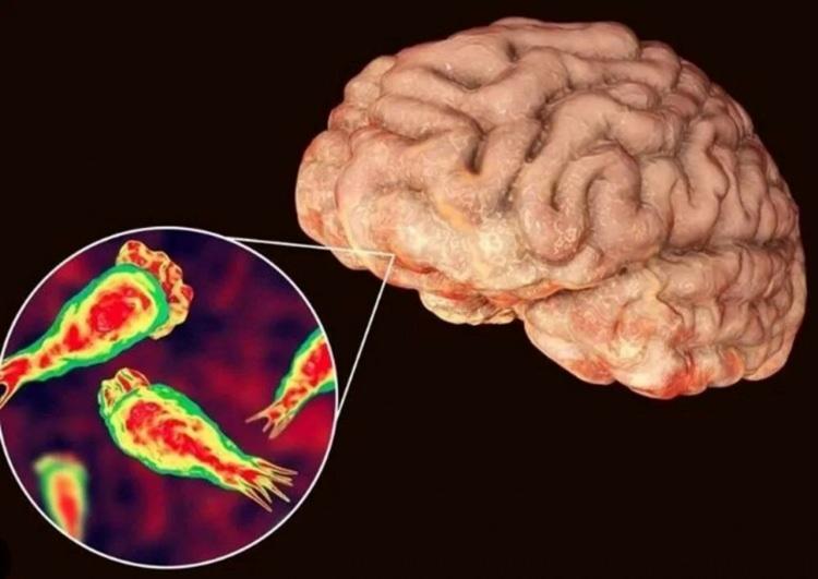 <p>Hastalığın teşhisinden sonra mikrop öldürücü ilaçlarla tedaviye başladıklarını anlatan Rauf, "Hastamız ilk gün nöbetlerden dolayı pek kendinde değildi. 3 gün içinde Afnan iyileşmeye başladı." diye konuştu.</p>
