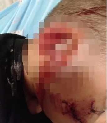 <p>Antalya'da 2 Haziran 2021'de 3 yaşındayken sevmek istediği k&ouml;peğin saldırısına uğrayan ve &ouml;l&uuml;mden d&ouml;nen Yağız &Ccedil;etin'in (6) babası Serhat &Ccedil;etin Sabah.com.tr'de verdiği r&ouml;portajında, sokak hayvanları yasasına tepki g&ouml;sterenlere sert &ccedil;ıktı.</p>
